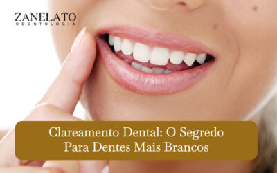 Clareamento Dental: O segredo para dentes mais brancos