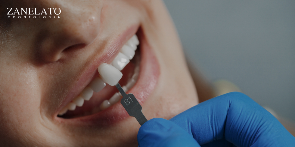 Dentes Pequenos: As Lentes de Contato Dental São a Solução
