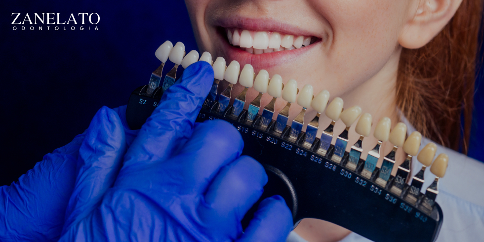 Lentes de Contato: Como o Procedimento Recupera os Dentes Danificados
